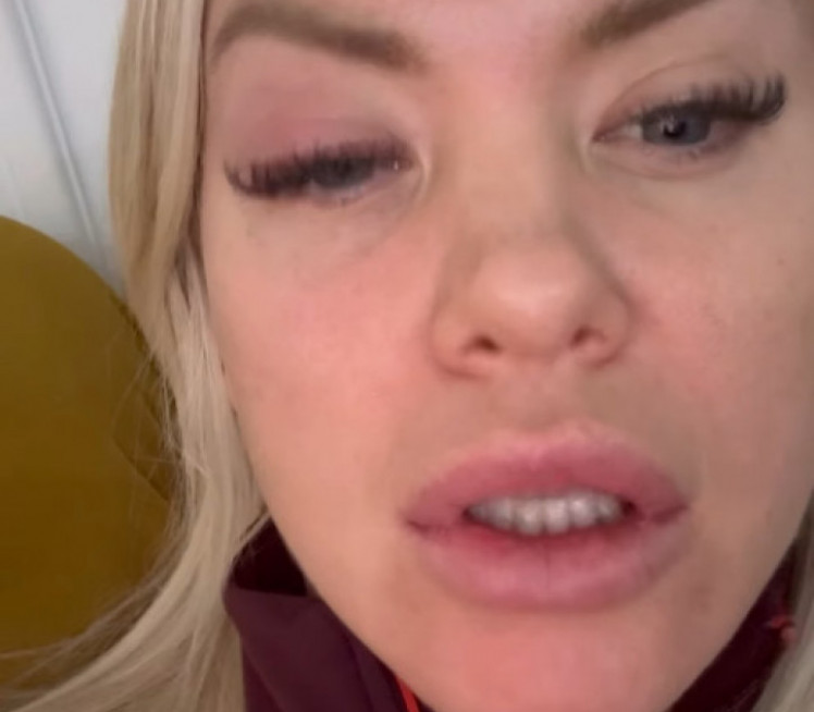 VODITELJKI ZATVORENO OKO: "Baš je strašno, baš me boli"