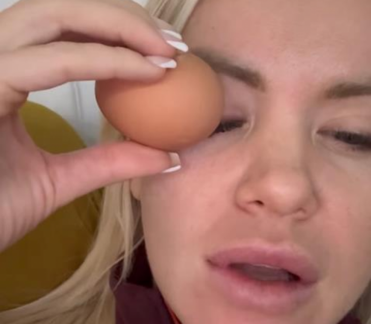 VODITELJKI ZATVORENO OKO: "Baš je strašno, baš me boli"