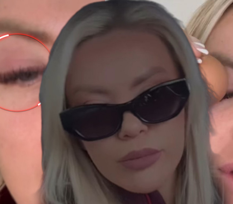 VODITELJKI ZATVORENO OKO: "Baš je strašno, baš me boli"