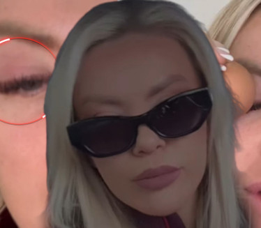 ВОДИТЕЉКИ ЗАТВОРЕНО ОКО: "Баш је страшно, баш ме боли"