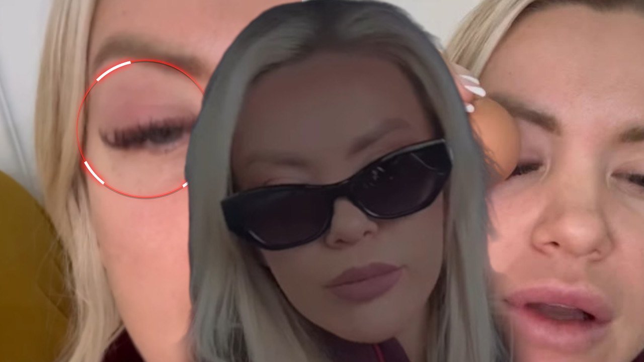 ВОДИТЕЉКИ ЗАТВОРЕНО ОКО: "Баш је страшно, баш ме боли"