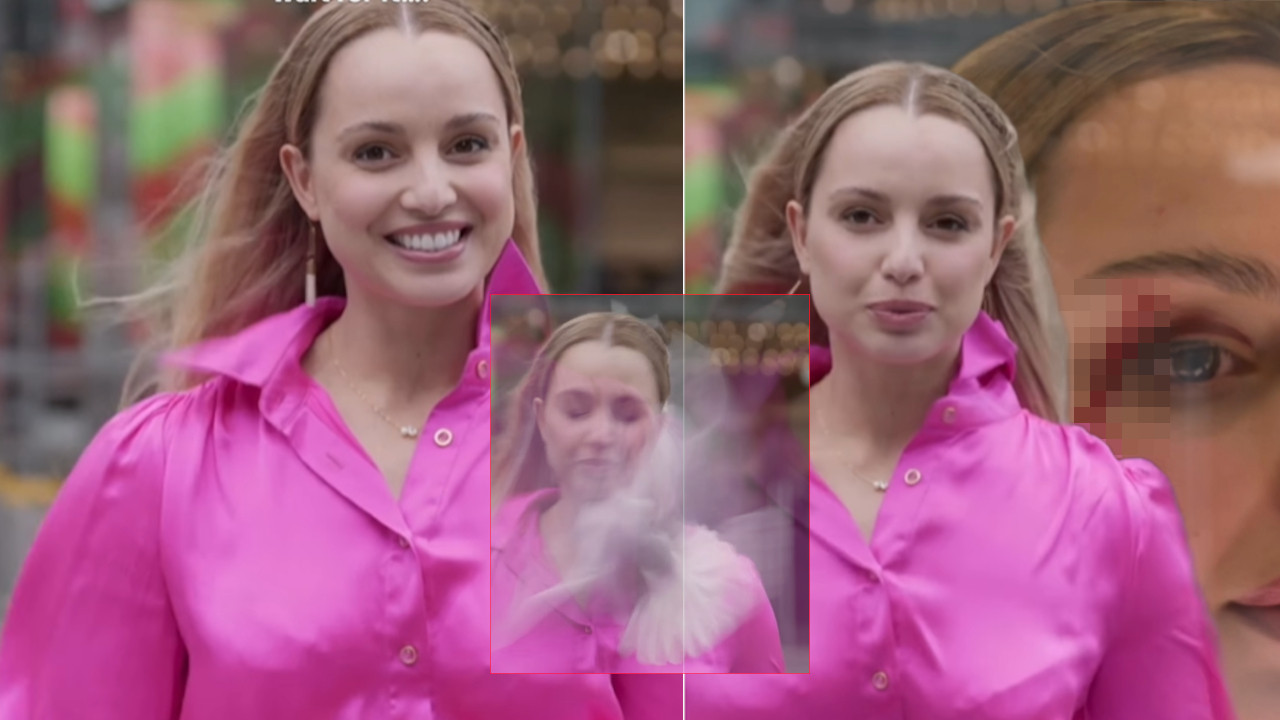 "NAPAD" U ŽIVOM PROGRAMU: Reporterka završila krvava (VIDEO)