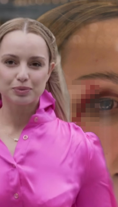 "NAPAD" U ŽIVOM PROGRAMU: Reporterka završila krvava (VIDEO)