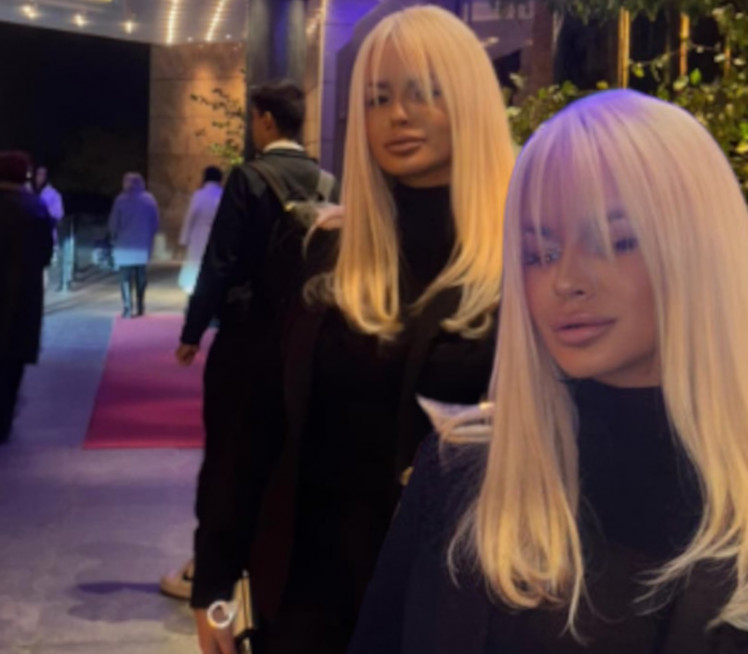 Posle vesti o gubitku bebe, DŽidža se prvi put OGLASILA