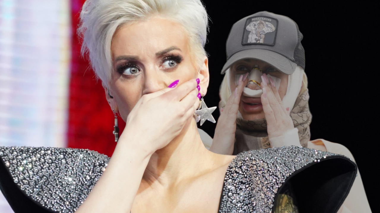 DUŠICA POVREĐENA: Drama u jutarnjim satima, modro i otečeno