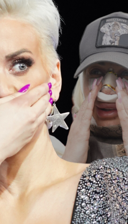 DUŠICA POVREĐENA: Drama u jutarnjim satima, modro i otečeno