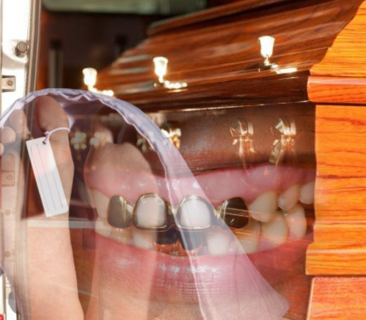 KRAO OD MRTVIH Pogrebnik u Nemačkoj prodao 8 kg zlatnih zuba