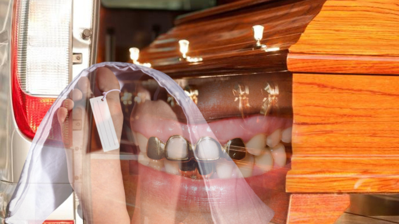 КРАО ОД МРТВИХ Погребник у Немачкој продао 8 кг златних зуба