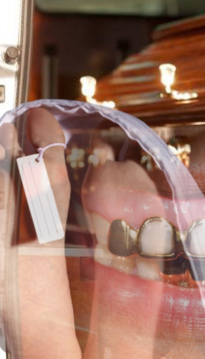 KRAO OD MRTVIH Pogrebnik u Nemačkoj prodao 8 kg zlatnih zuba