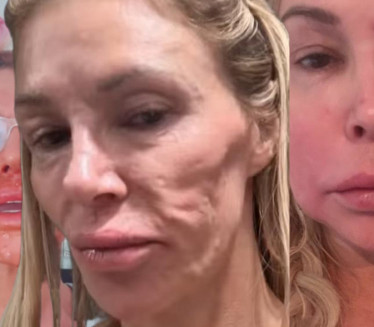 БРЕНДИ УНИШТЕНО ЛИЦЕ: Остала и без зуба!