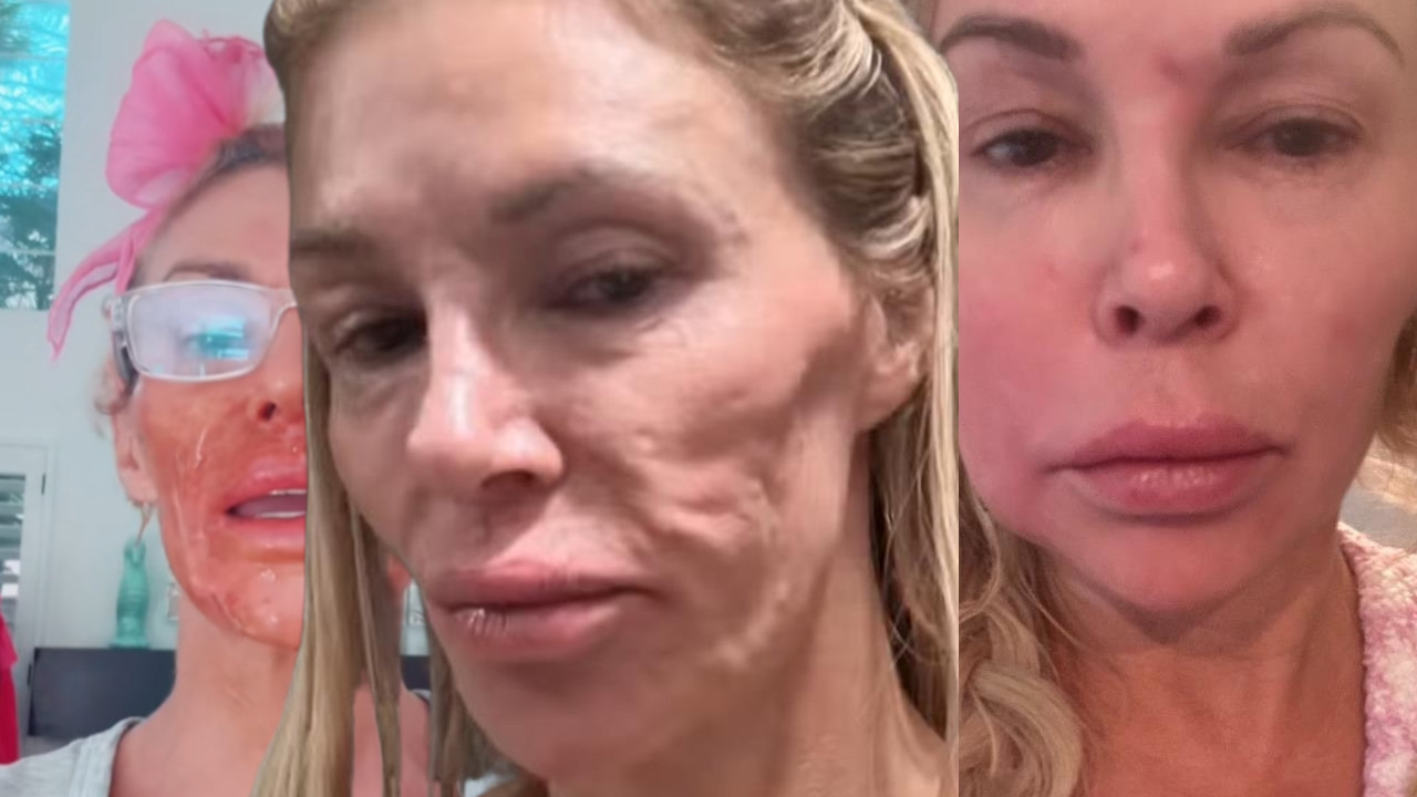 БРЕНДИ УНИШТЕНО ЛИЦЕ: Остала и без зуба!