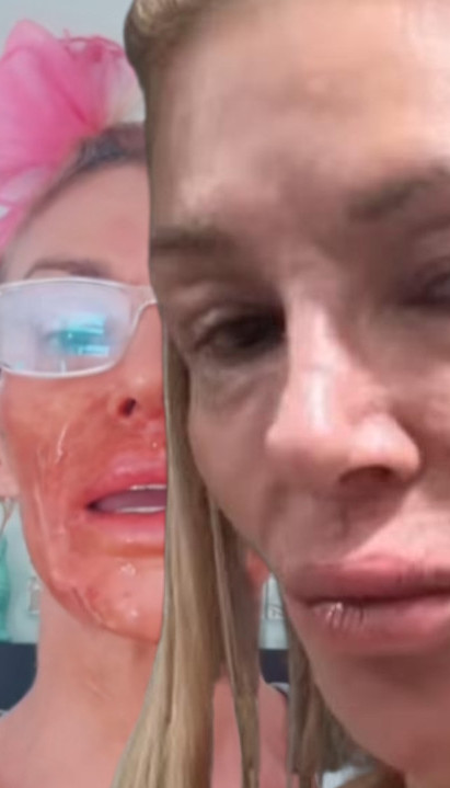 БРЕНДИ УНИШТЕНО ЛИЦЕ: Остала и без зуба!