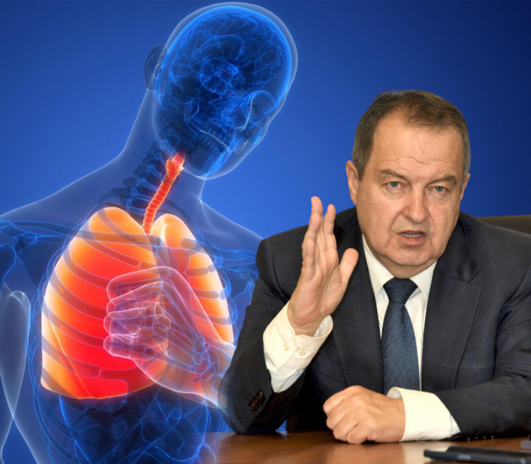 JOŠ SE BORI ZA ŽIVOT Simptomi bolesti zbog koje je u bolnici