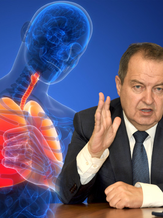 JOŠ SE BORI ZA ŽIVOT Simptomi bolesti zbog koje je u bolnici
