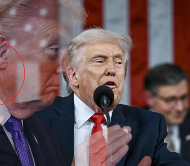 ŠTA MU JE TO NA VRATU? Nove brige oko Trampovog zdravlja