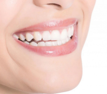 ТРИК ЗА БЛИСТАВ ОСМЕХ Ово поврће делује као природна четкица