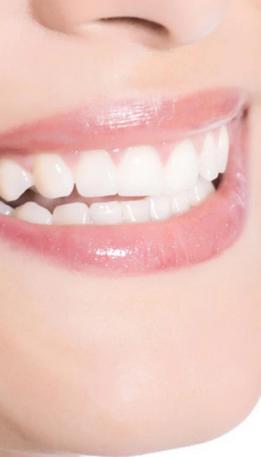 TRIK ZA BLISTAV OSMEH Ovo povrće deluje kao prirodna četkica