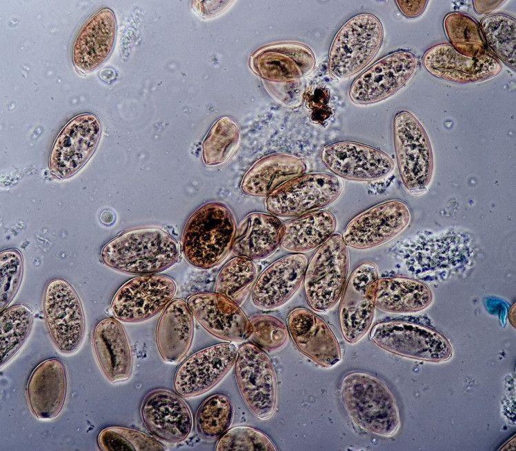 BRIŠE GRANICU ŽIVOTA Otkrili organizam - ni virus, ni ćelija