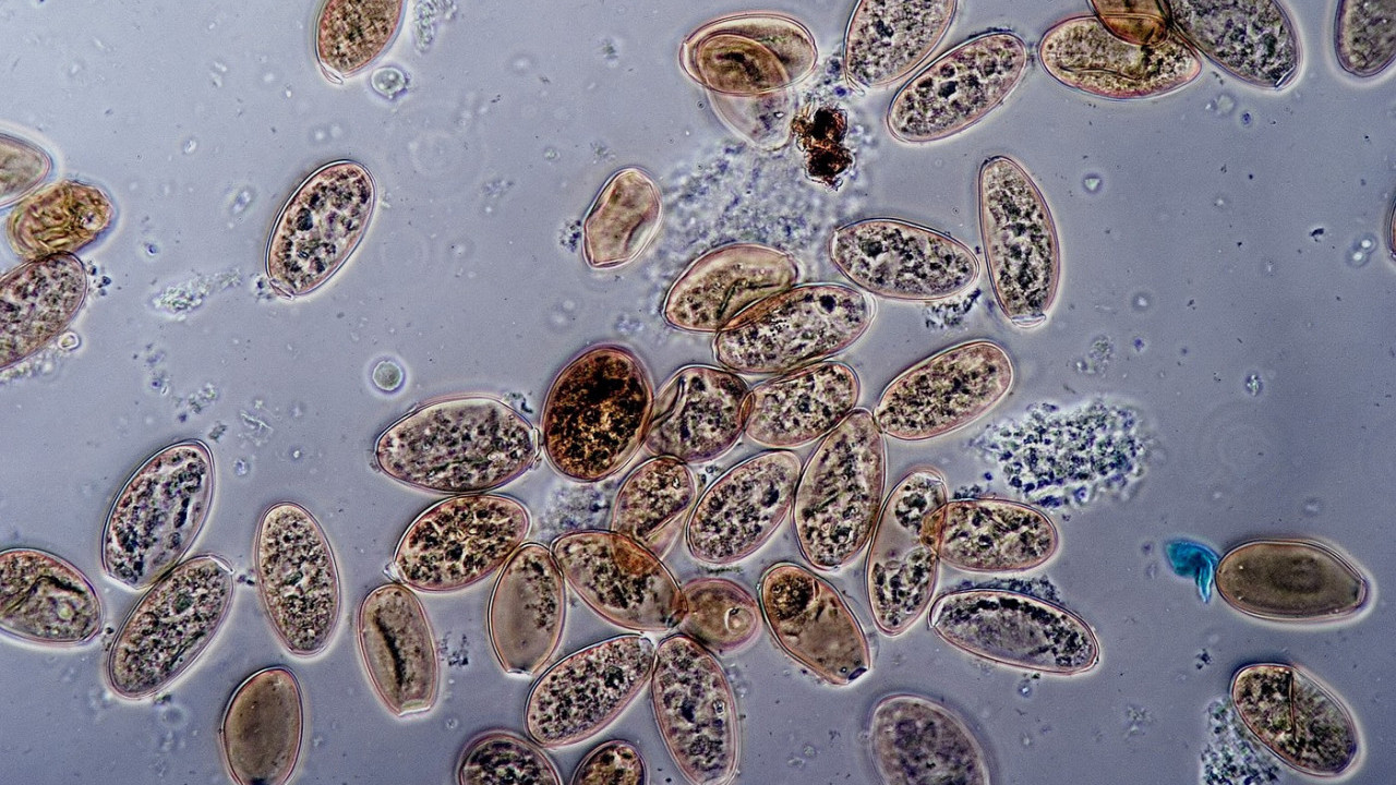 БРИШЕ ГРАНИЦУ ЖИВОТА Открили организам - ни вирус, ни ћелија