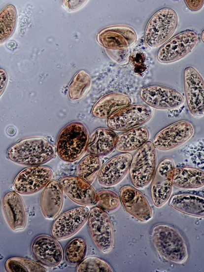 BRIŠE GRANICU ŽIVOTA Otkrili organizam - ni virus, ni ćelija