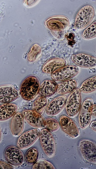 BRIŠE GRANICU ŽIVOTA Otkrili organizam - ni virus, ni ćelija