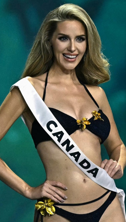 U bikiniju na Mis Univerzum, sad otkrila - bila u 4. mesecu