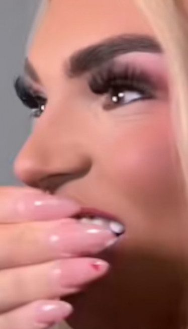 "Ja bih tražila da mi vrate pare", a zube platila kao stan