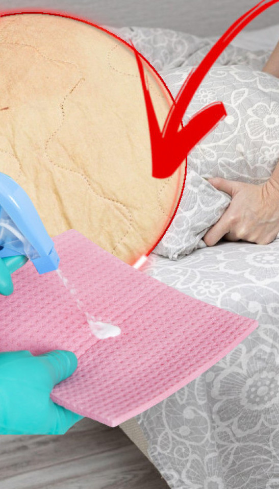 IZGLEDAĆE KAO NOV Kako najlakše skinuti žute fleke sa dušeka