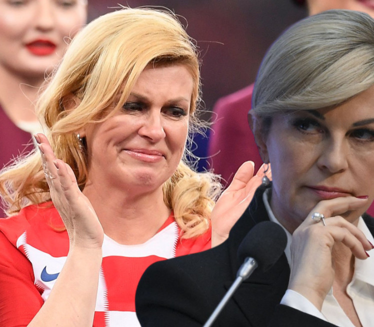 Objavila sliku otečene ruke: Kolinda iskreno o zdravlju