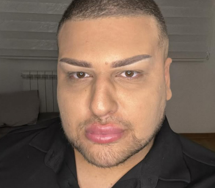 "MAJKA JE BILA U KOMI": Tiktokeru hteli da uzmu nasledstvo