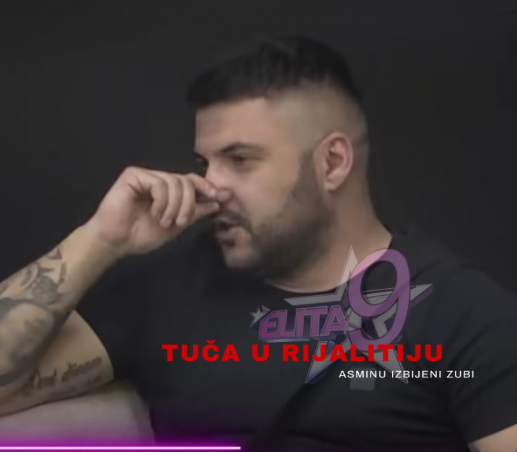 Након што су му сломљени зуби:Ево како изгледа Асминово лице