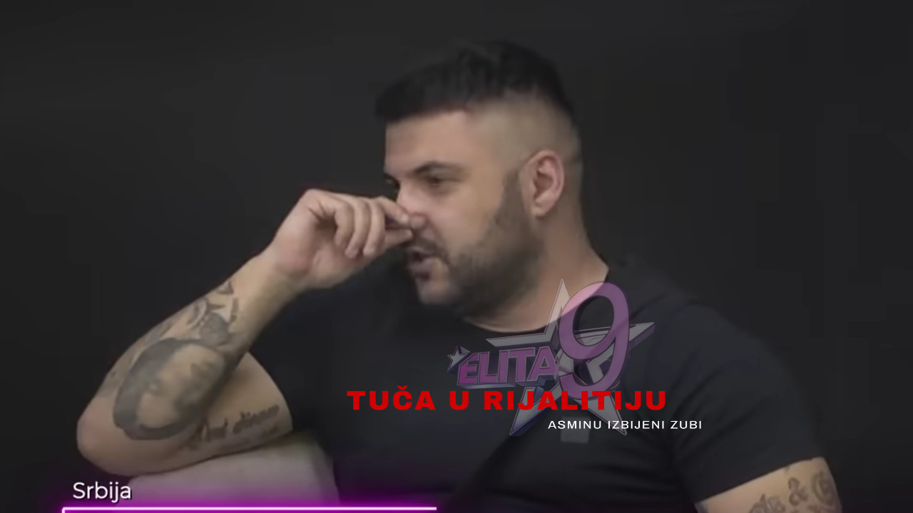 Након што су му сломљени зуби:Ево како изгледа Асминово лице