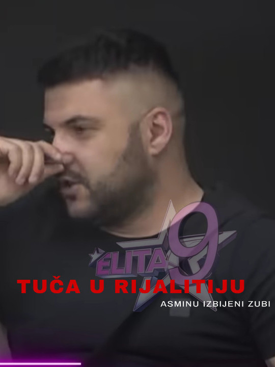 Након што су му сломљени зуби:Ево како изгледа Асминово лице