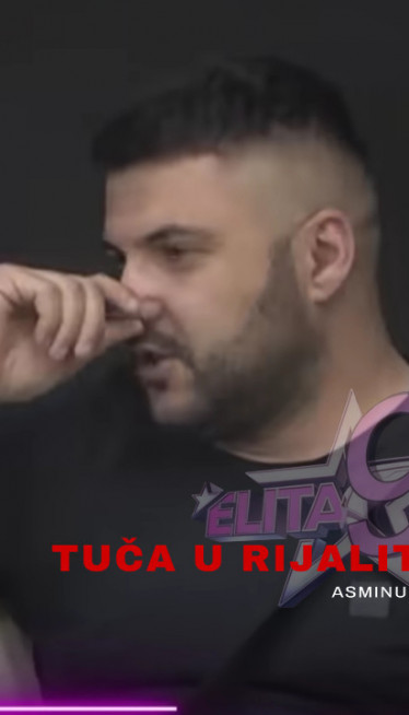 Nakon što su mu slomljeni zubi:Evo kako izgleda Asminovo lice