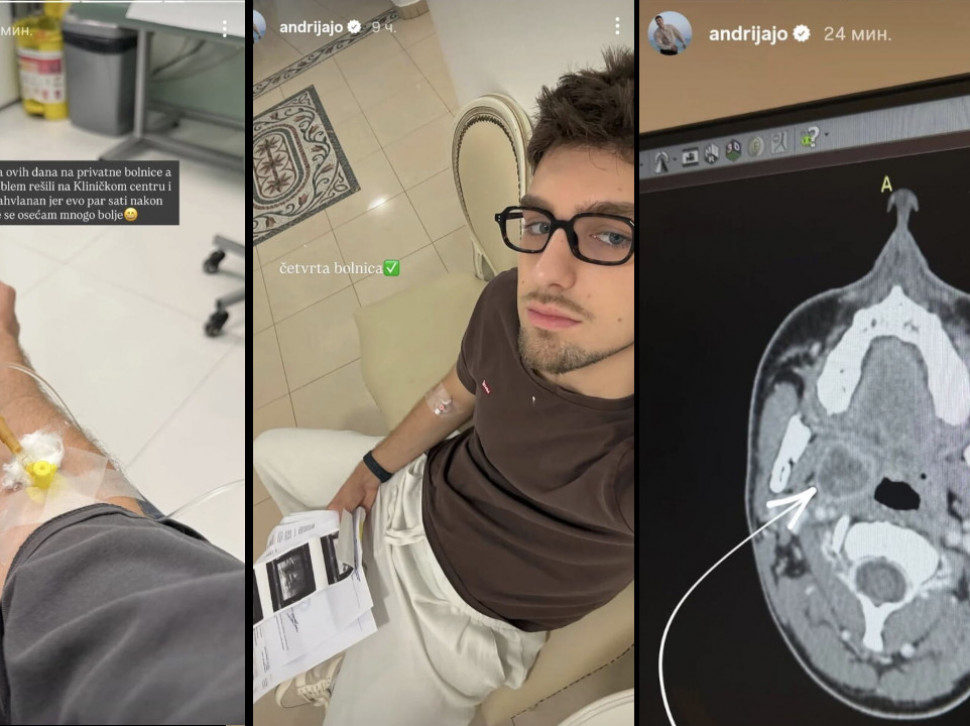 Andrija Jo hitno operisan – skenerom mu našli loptu u glavi