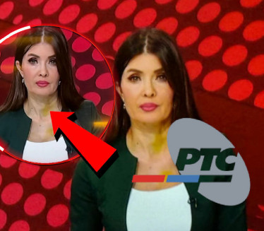 Voditeljka u modricama vodila "Dnevnik" - gledaoci zabrinuti