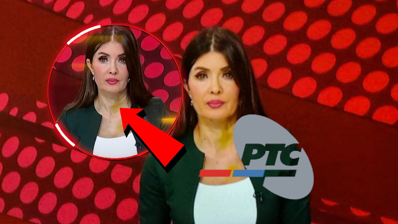 Voditeljka u modricama vodila "Dnevnik" - gledaoci zabrinuti