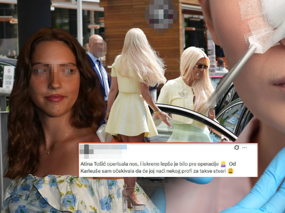 Jelenina ćerka operisala nos: Fotka Atine (17) usijala mreže
