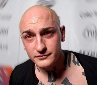 Десингерици нагло позлило: Репер хитно хоспитализован