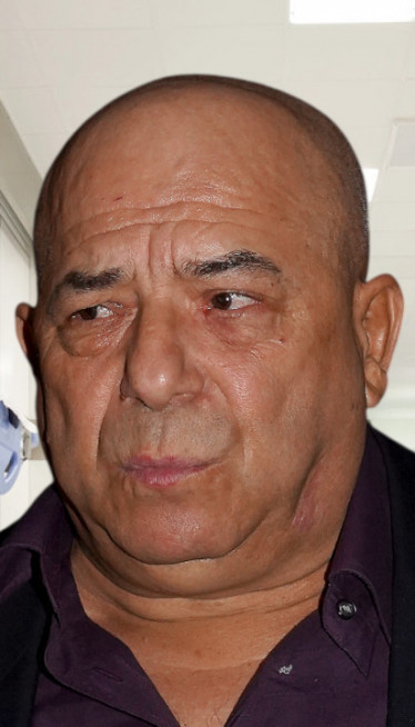 "Ceo sam u ranama": Hasan napustio BG, zdravlje mu ugroženo