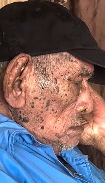 Hoze tvrdi da je najstarija živa osoba na svetu (Video)