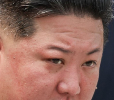 U opasnosti je: Kim DŽong Un ima 140kg