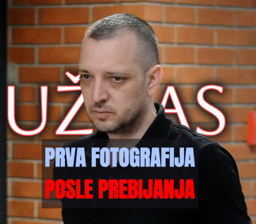 Jeziva slika: Vidite kako Marjanović izgleda posle prebijanja