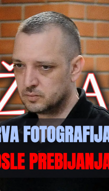 Језива слика: Видите како Марјановић изгледа после пребијања