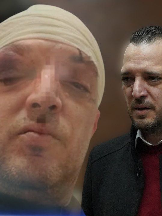 Ima ozbiljne posledice? Evo zašto Marjanović neće u javnost