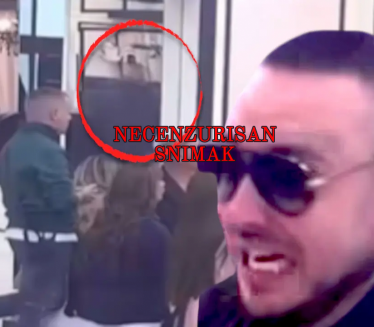 (НЕЦЕНЗУРИСАН СНИМАК) Ево како је Филипу Цару сломљена нога