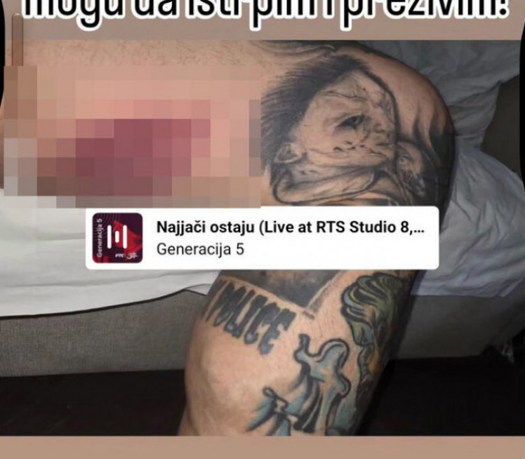 OGLASIO SE KRISTIJAN Posle vesti da je brutalno pretukao stariju ženu: "Pokidana mi sva meka tkiva, moram na skener glave, stradalo mi je srce"