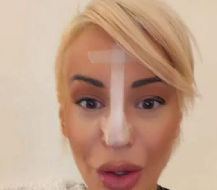 Dušici Jakovljević pao vrh nosa (foto)